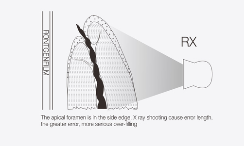Disadvantage of X Ray Film