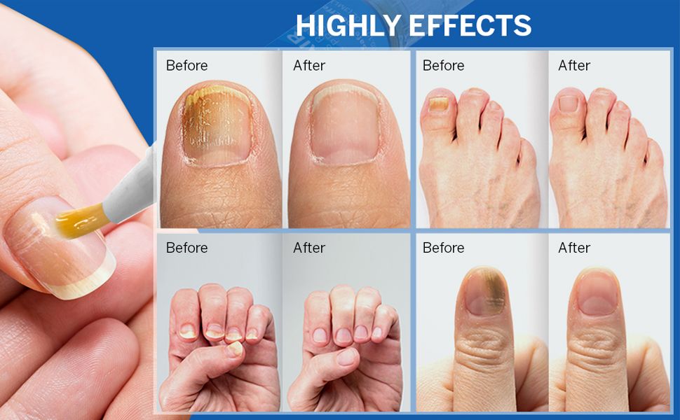 Highly effects