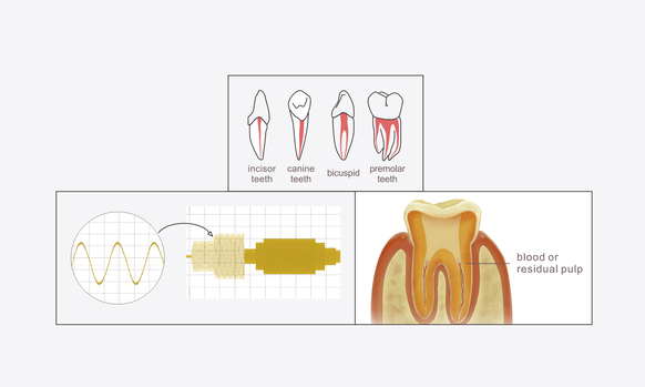 Multi-frequency apical position technology