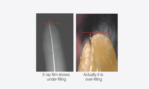 Disadvantage of handing method