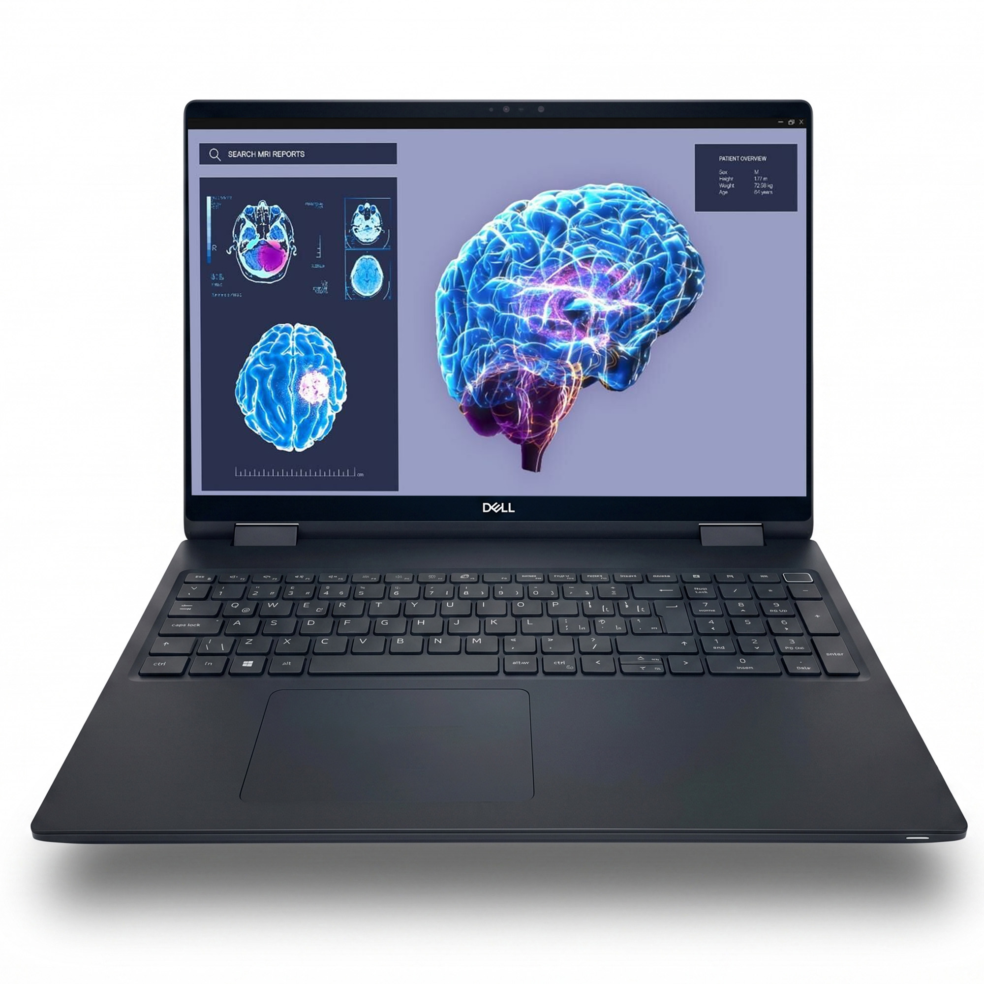 Dell Precision M7680A006 I9-13950HX 64GB 2tbssd RTX5000 16 Fiyatı
