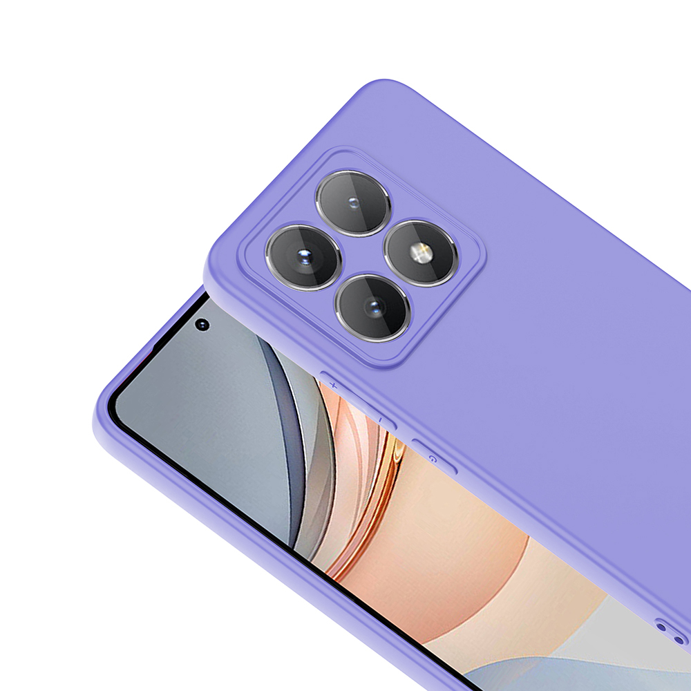 Xiaomi 14T Kılıf Zore Mara Lansman Kapak - 11