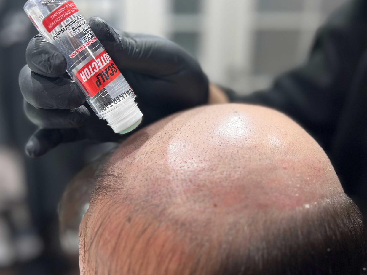 2. Scalp KULLANIMI