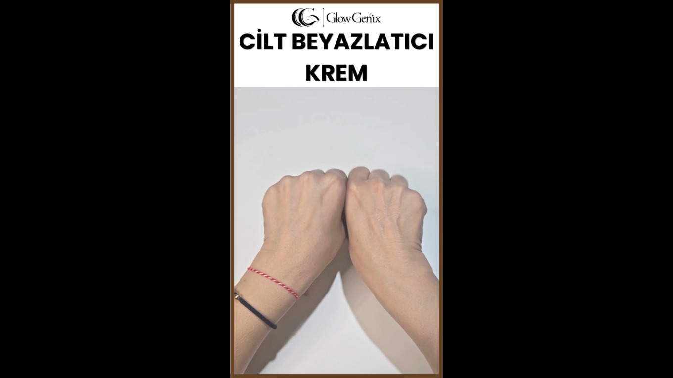 Video Banner