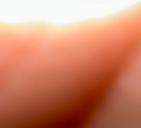 visual-comment-img