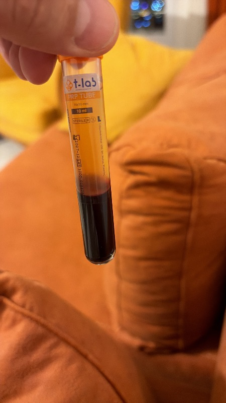 T-Lab Prp Tubes 1 Paket 2 Tüp