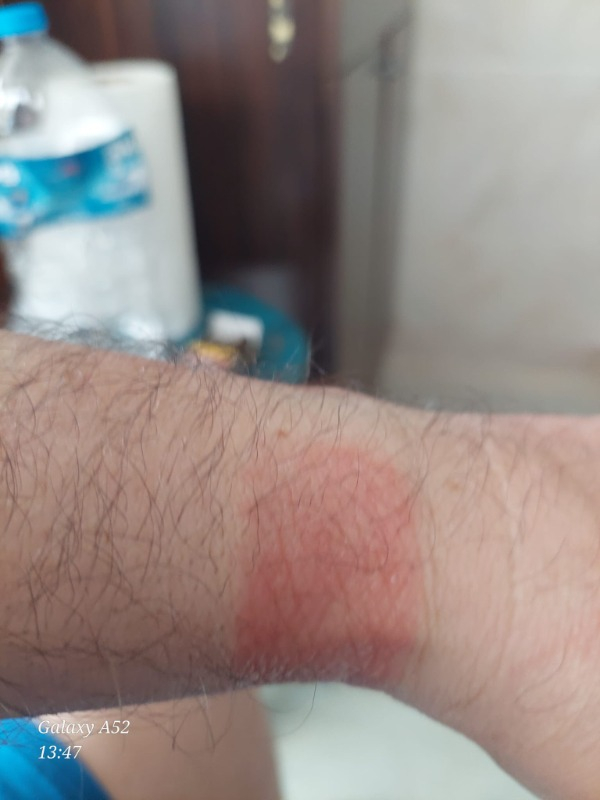Huaweı Watch D2 – Siyah Kauçuk