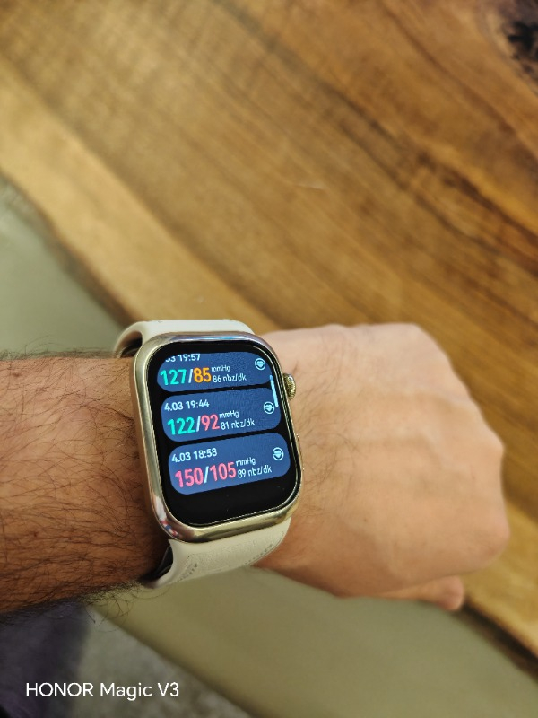 Huaweı Watch D2 – Altın Beyazı Kompozit Deri