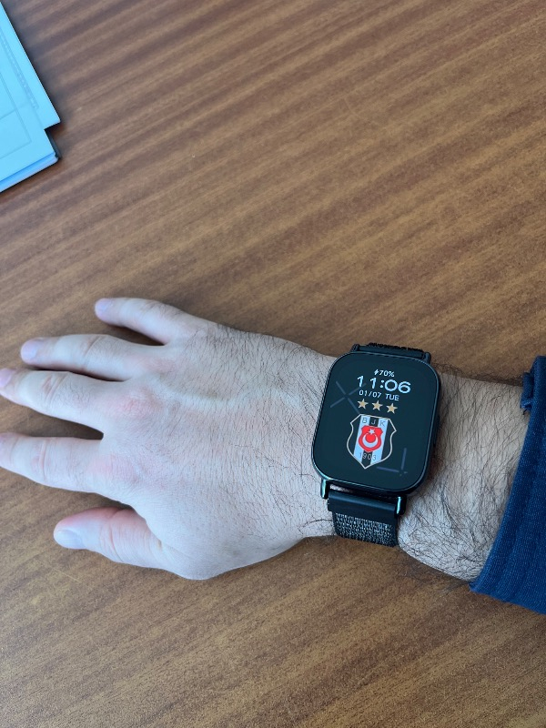 Xiaomi Redmi Watch 5 Lite Akıllı Saat Sesli Görüşme Özellikli