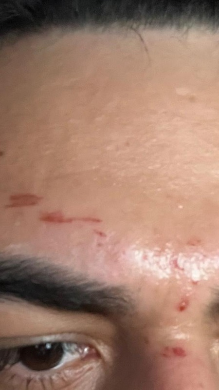 Veet Professional Yüz Ağda Bandı 20'li Hassas Ciltler