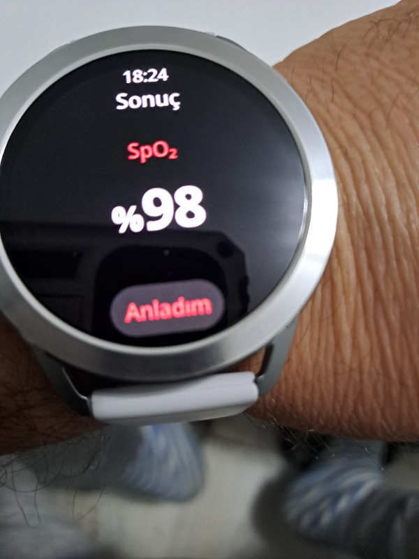 Xiaomi Watch S3