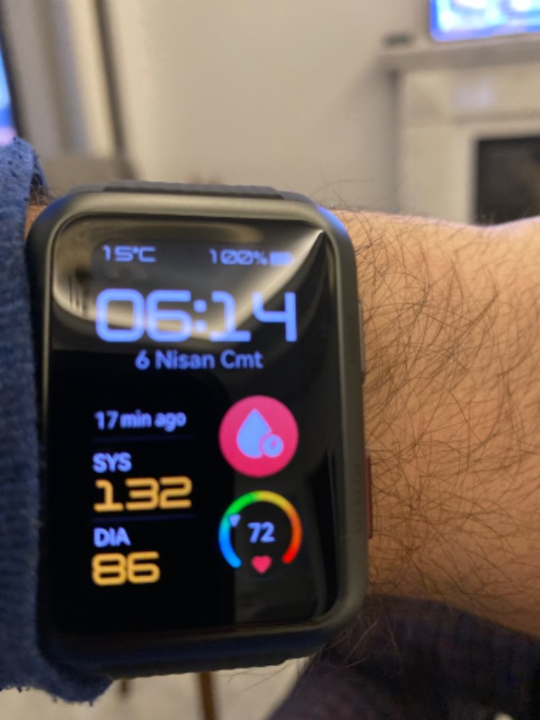 Huawei Watch D - Siyah