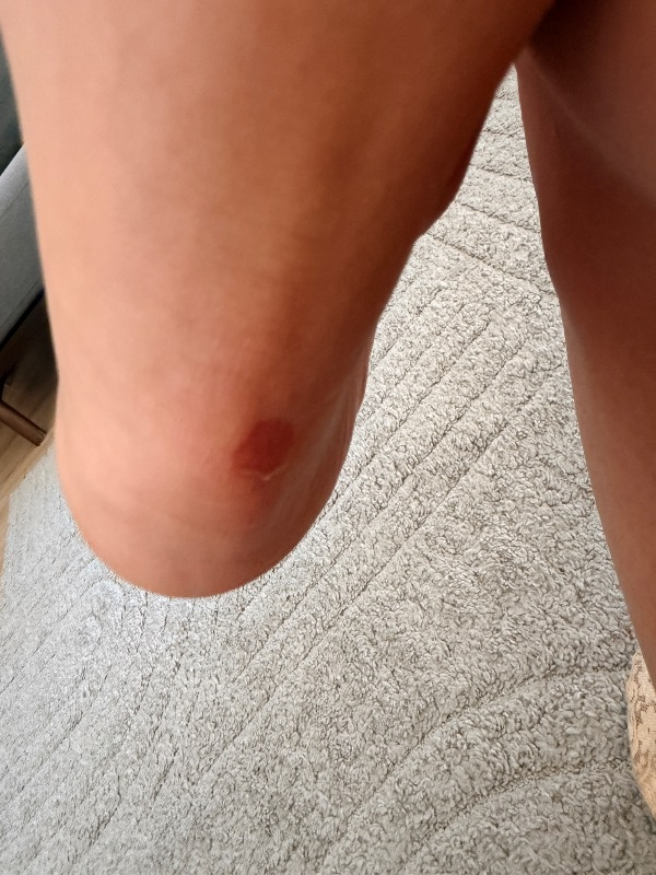 Compeed Sürtünme ve Kabarcık Oluşumuna Karşı Ayak ve Vücut İçin Sürtünme ve Kabarcık Önleyici Stick - 8 ml