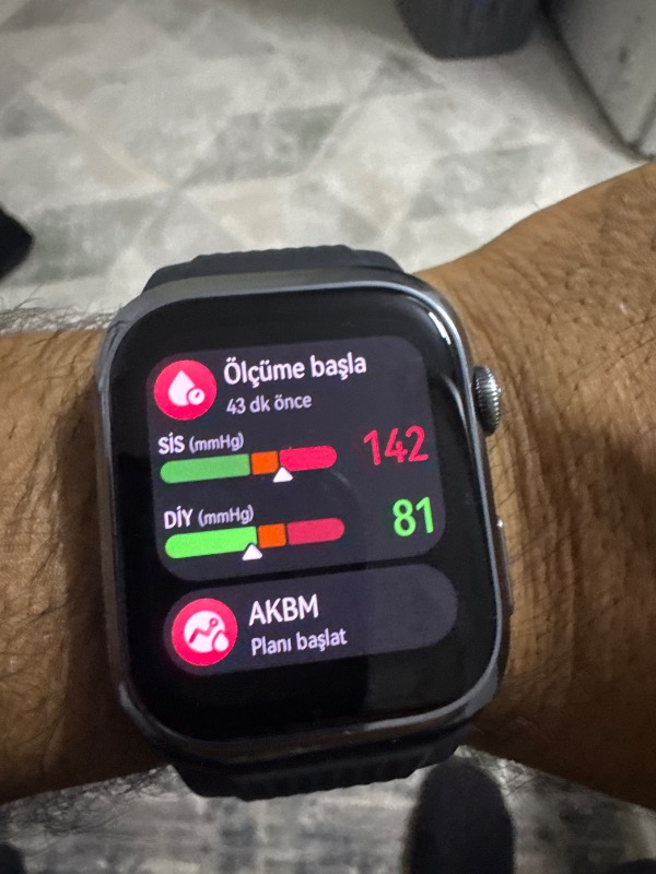 Huaweı Watch D2 – Siyah Kauçuk