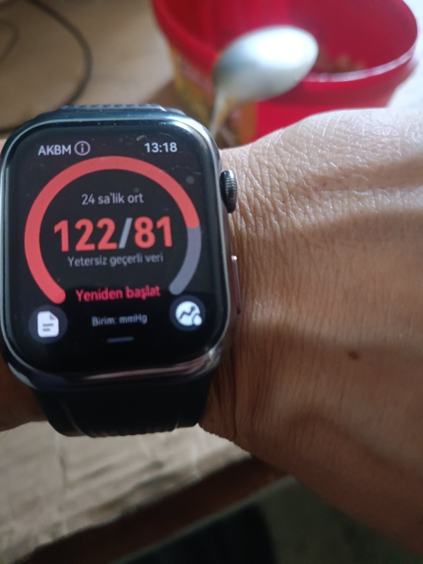 Huaweı Watch D2 – Siyah Kauçuk