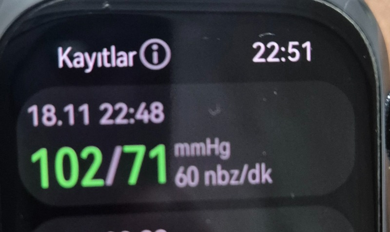 Huaweı Watch D2 – Siyah Kauçuk