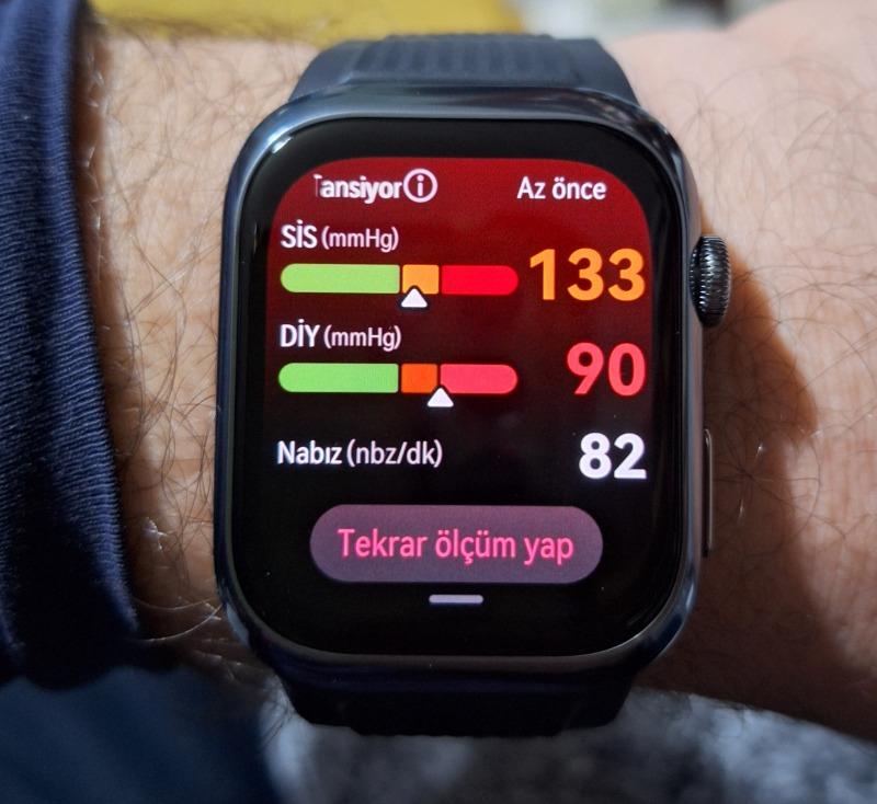 Huaweı Watch D2 – Siyah Kauçuk