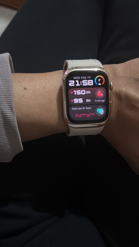 Huaweı Watch D2 – Altın Beyazı Kompozit Deri