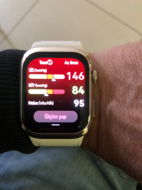 Huaweı Watch D2 – Altın Beyazı Kompozit Deri