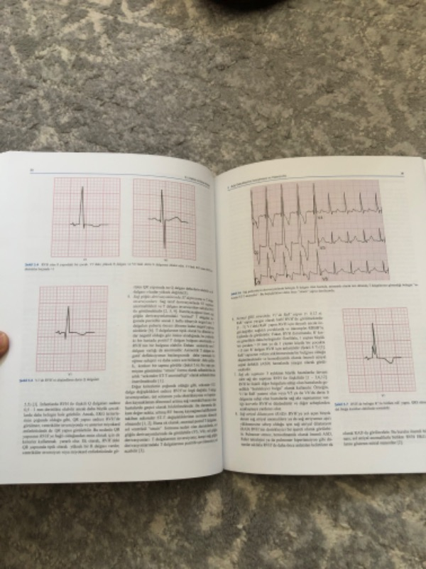 Ema Tıp Kitabevi Ekg'yi Anlamak Set